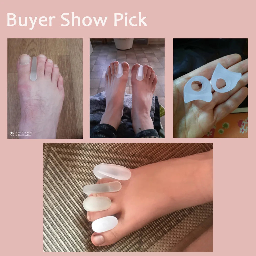 1 Pair Silicone Bone Thumb Orthotics Corrector Hallux Valgus Toe Separator Feet Care Thumb Orthotics Foot Care Tools 2020 S/L.