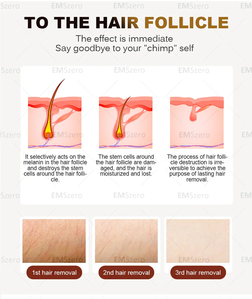 3000W Diode Laser Freezing Point Painless Hair Removal Picosecond Laser 532/1220/1064/755 Tattoo Removal Two In One Machine.