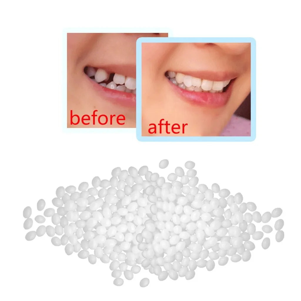 Temporary Tooth Repair Beads Missing Broken Teeth Dental Tooth Filling Material Food Grade FalseTeeth Solid Glue Denture.
