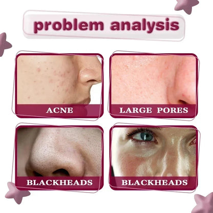 Pore Shrink Face Serum Salicylic Fruit Acid Essence Whitening Moisturizing Nourish Smooth Pores Repair Anti-age Korean Cosmetics.