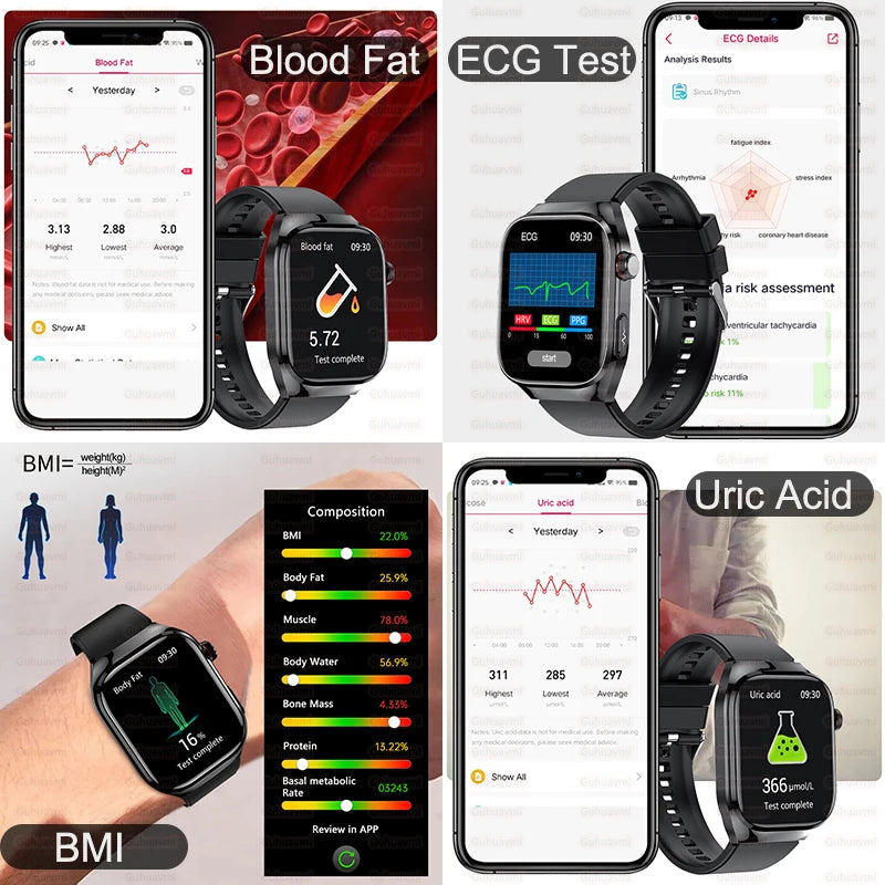 2025 New For XIAOMI Uric acid Blood lipids Smart Watch Men ECG+PPG Blood pressure Blood oxygen Bluetooth Call Health Smartwatchs.