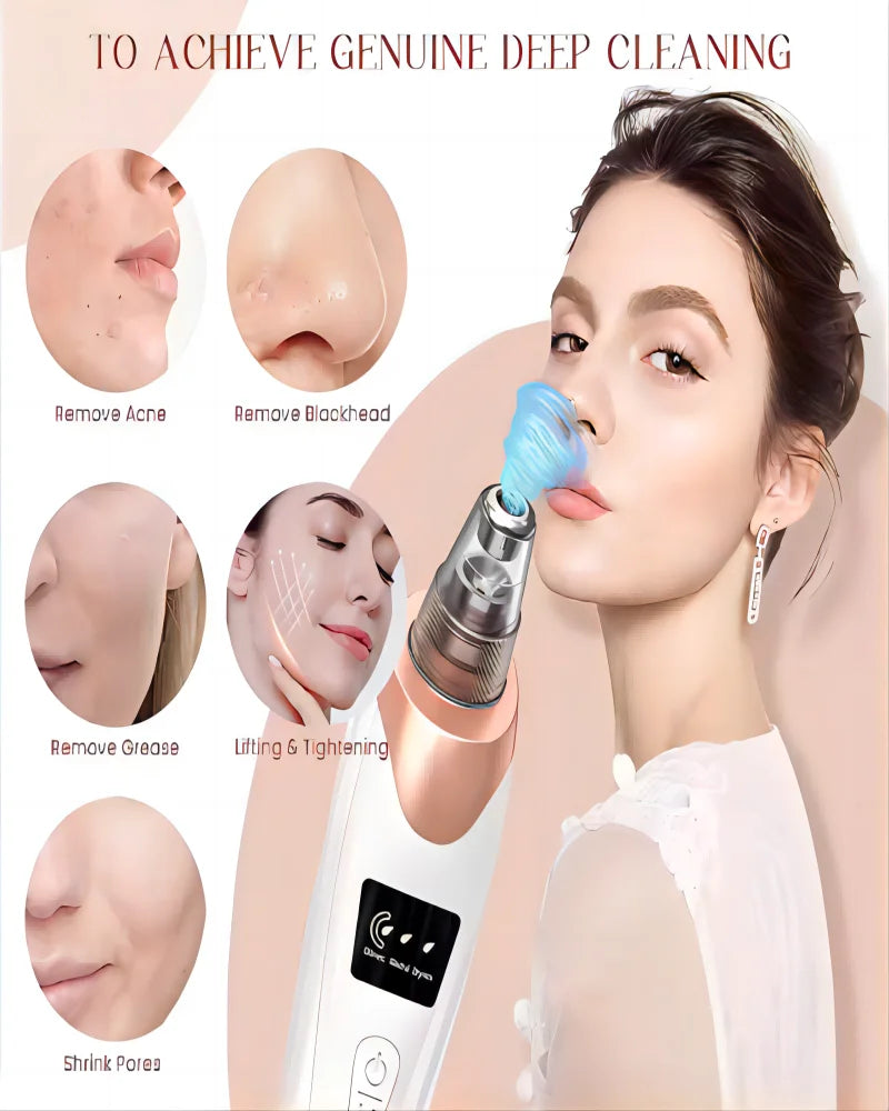 Newest Technology Blackhead Remover Vacuum Pore Cleaner for Face&Nose Blackhead Removal Kit Electric Acne Facial Extractor Tool.