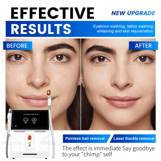 3000W Diode Laser Freezing Point Painless Hair Removal Picosecond Laser 532/1220/1064/755 Tattoo Removal Two In One Machine.