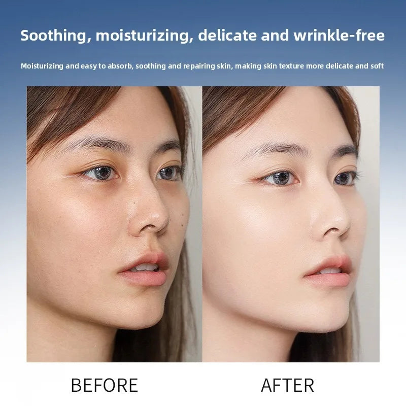 Hyaluronic Acid Serum Anti-Aging Moisturizing Shrink Pores Hydrating Whitening Essence For Microneedle Instruments Skin Care.