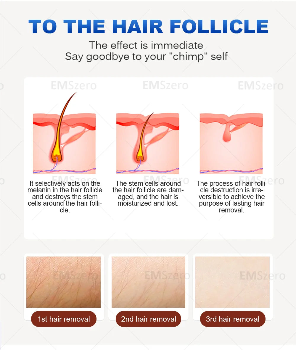 3000W Diode Laser Freezing Point Painless Hair Removal Picosecond Laser 532/1220/1064/755 Tattoo Removal Two In One Machine.