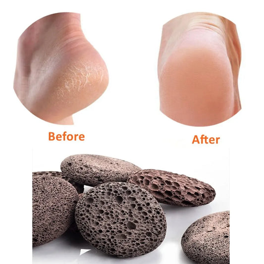 Pumice Stone , Scrubber Stone Pedicure Tools Natural Foot Scrubber for Exfoliation to Clear Callus on Hands Heels and Body.