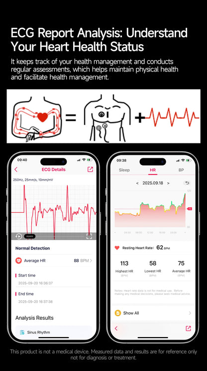 1.43'' HD Sapphire Smart Watch Bluetooth Call Blood Fat Uric Acid Heart Rate Body Analysis Five Organs Health Smartwatch Men Wom.