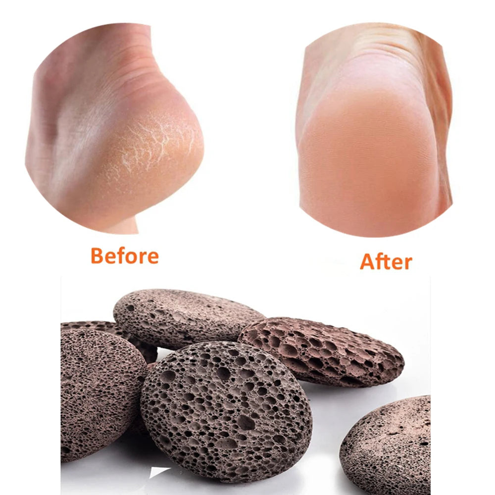 Pumice Stone , Scrubber Stone Pedicure Tools Natural Foot Scrubber for Exfoliation to Clear Callus on Hands Heels and Body.