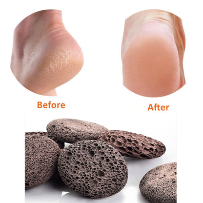 Pumice Stone , Scrubber Stone Pedicure Tools Natural Foot Scrubber for Exfoliation to Clear Callus on Hands Heels and Body.