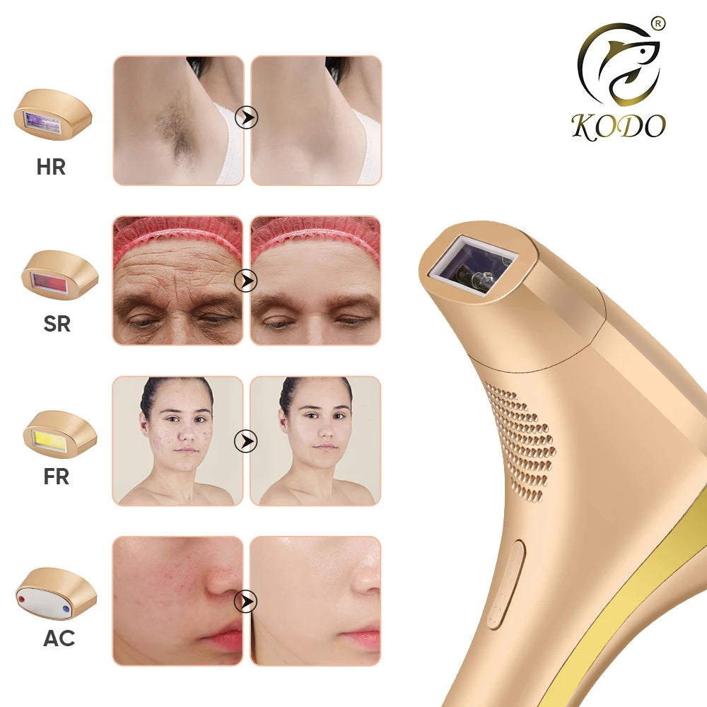 KODO 2025 High-end customization ice Laser Hair removal Laser Epilator Permanent IPL Painless Photoepilator 4 in 1 face and body.